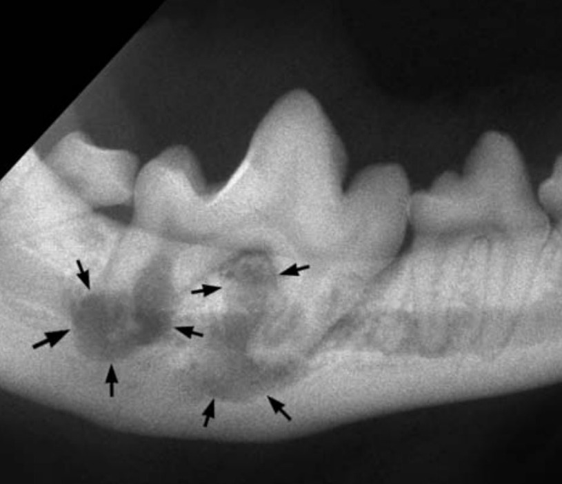 Tooth resorption