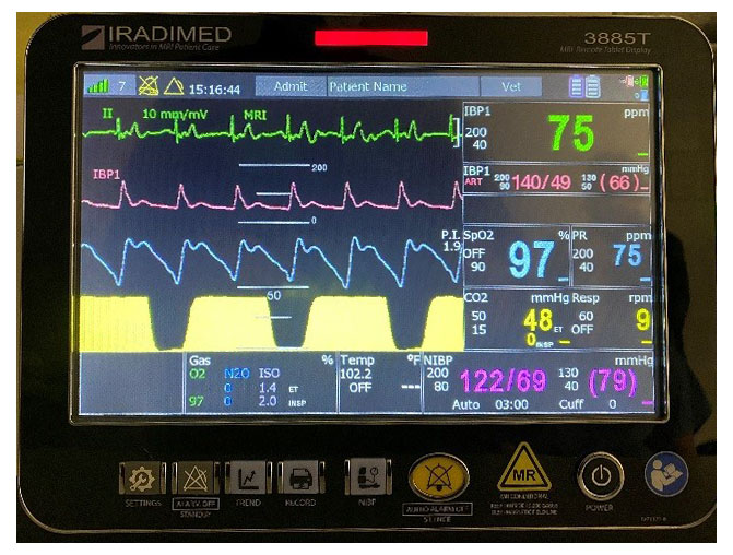 Anesthesiology tech